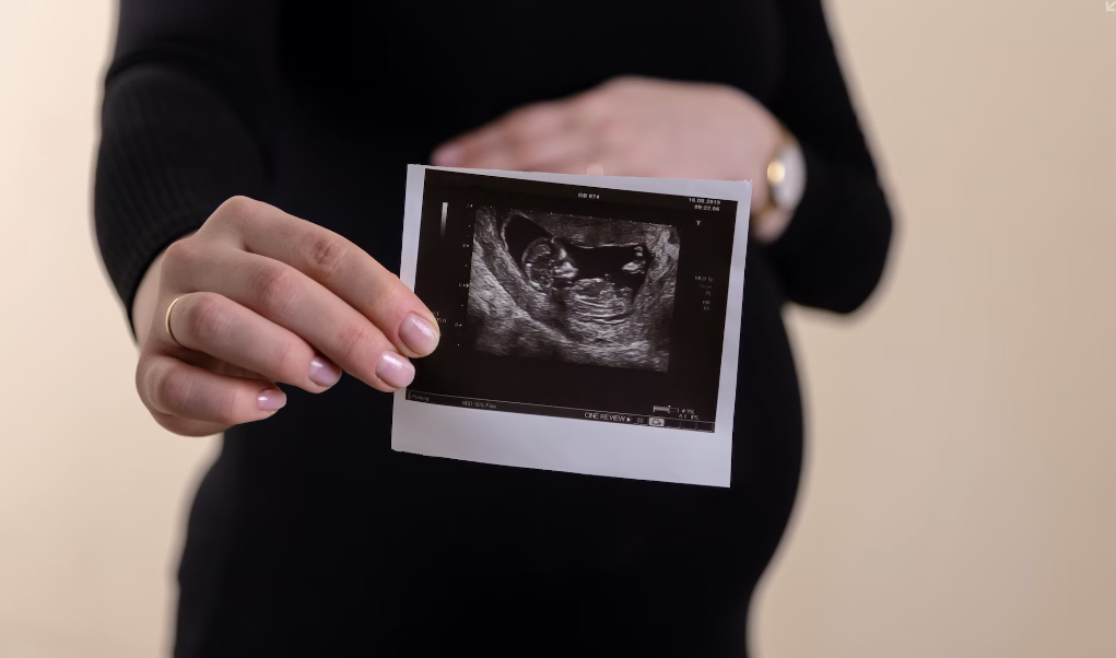 Prenatal screening